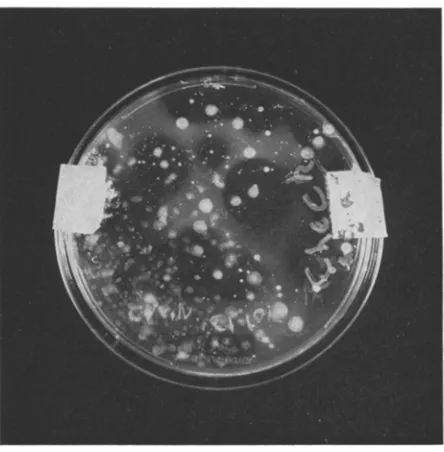 Fig. 3: Diatom growth inhibition by bacterial colonies on selective isolation agar plate streaked with a raw sample from the field 