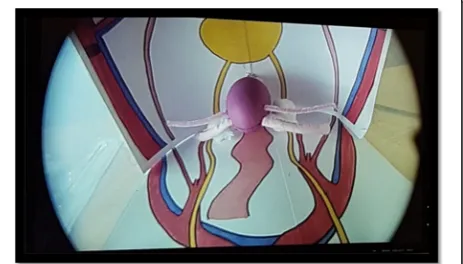 Fig. 1 Laparoscopic view of homemade pelvic box trainer withanatomical landmarks to improve training experience