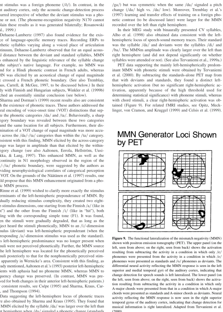 Figure 9. The functional lateralization of the mismatch negativity ~MMN!