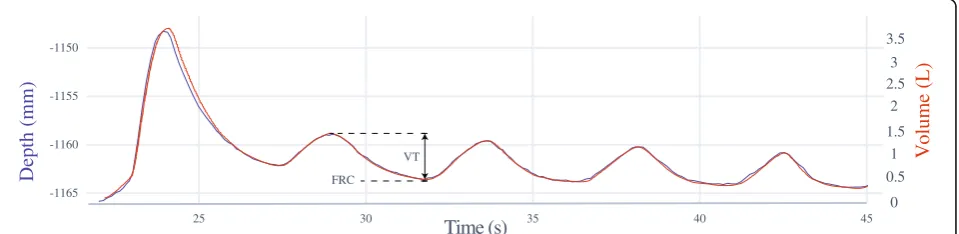 Fig. 5 Supine position. Superimposed graphs of mean depth, measured by the Kinect (VT(blue, left axis) and volume, measured with spirometryred, right axis) of a volunteer in the supine position