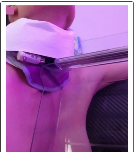 Fig. 2 Patient measurement (MLO view) with modified thyroidprotection collar and external dosimeter.