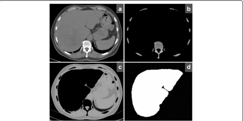 Fig. 2 Preparation of the patient-inspired in-silico synthetic liver model for the numerical SPCCT experiments