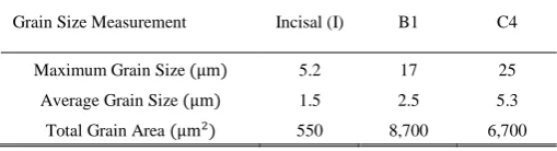 Fig.  2. Generated spectrum of counts per second per electron volt (cps/eV)  against incident X-ray energy (keV) of the Incisal porcelain sample