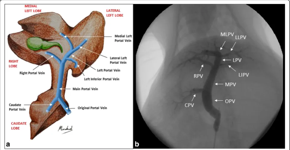 Fig. 1 aand left portal vein (left portal vein ( Anatomy of rabbit liver. b Direct portography of a conventional rabbit portal system anatomy (anatomic variation type 1)