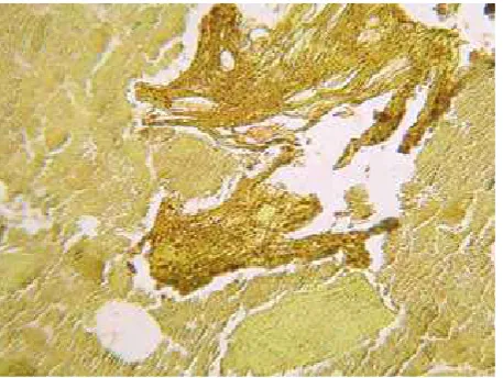 Figure 3. Model sample No. 7-C (minced meat and soya isolate). DAB chromogen and Calleja staining (magnifi-cation 25×)