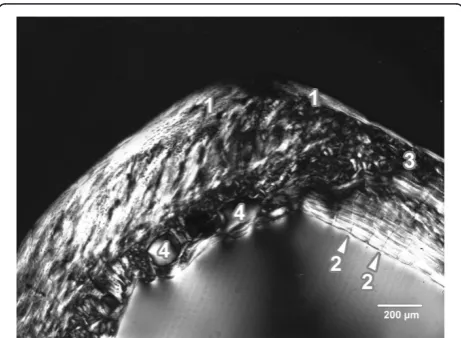 Figure 1 Microscopic structure of compact bone in rat from thecontrol group. 1- non-vascular bone tissue