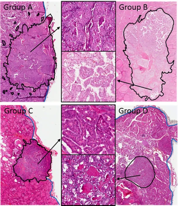 Figure 5. Histologic appearance of the microcarcinoma groups (hematoxylin and eosin sections)