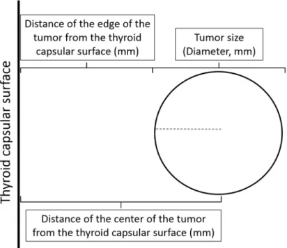 Figure 1. Distance of the center of the tumor from the thyroid surface. The distance of the center of  the tumor from the thyroid surface is measured by adding the separate micrometric values of the  distance of the edge of the tumor from the thyroid surfa