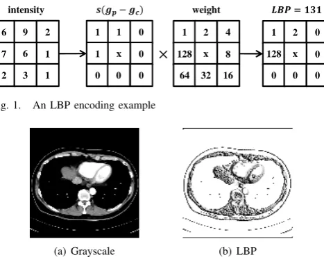 Fig. 1.An LBP encoding example