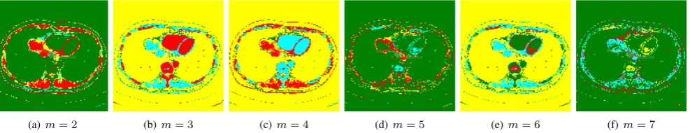 Fig. 9.Clustering results of CT52 using FCMm with K = 4