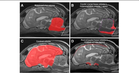 Figure 1 Image segmentation for volume determination. Image segmentation of cranial compartments and their parenchymal contents