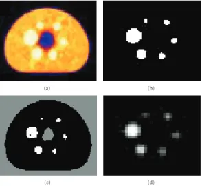 Figure 5: Phantom data set 1: (a) Original PET image (168(d) segmented image (84 × 168), (b) thresholded image (168 × 168), (C) clustered image (168 × 168), × 84) using ANN and MRA, zoomed by a factor of 2.