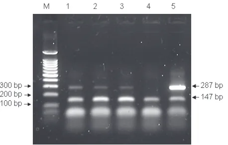 Figure 1. PCR products generated from the target sequen-ces in Campylobacter spp. (287 bp) and internal control (0.05 pg/µl) (147 bp) 