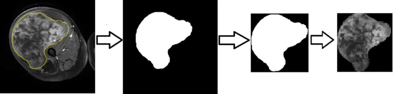 Figure 3.2. ROI delineation and mask