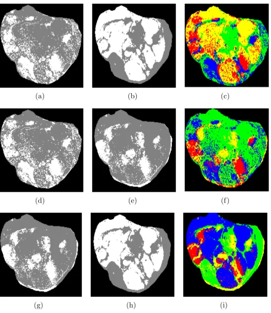 Figure 3.4. Overlapped habitats on multi-sequences MRI