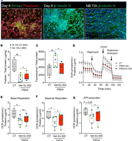 Figure 5. Exenatide alleviates oxidative stress and mitochondrial dysfunction in FRDA patients’ iPSC-derived sensory neurons