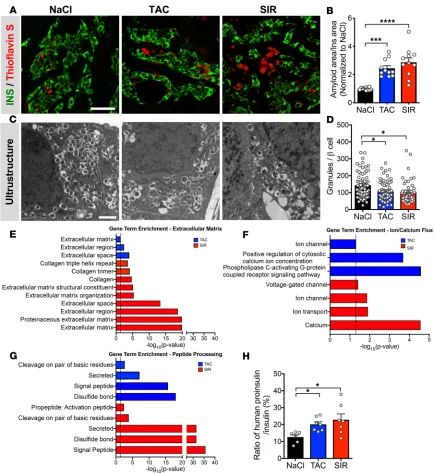Figure 2. Mechanisms of TAC- and SIR-induced β cell dysfunction of human islets in vivo