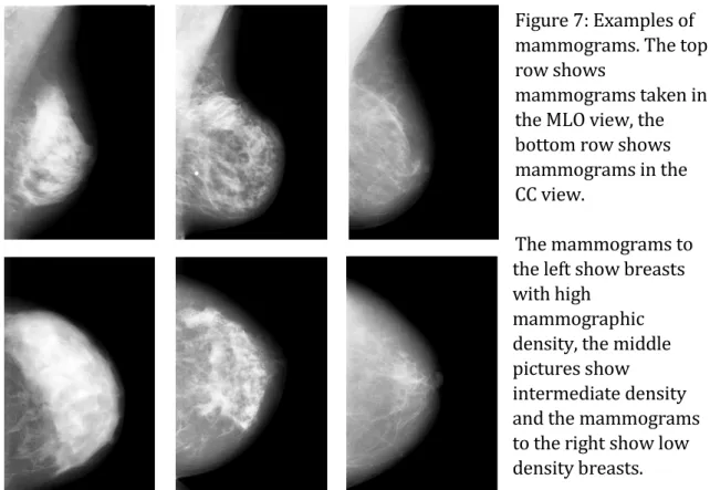 Figure 7: Examples of  mammograms. The top  row shows 