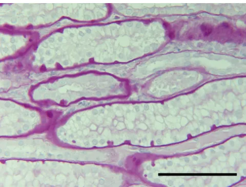 Figure 1Kidney, dogKidney, dog. Periglomerular interstitial infiltration of plasma-lymphocytic cells following pyometra