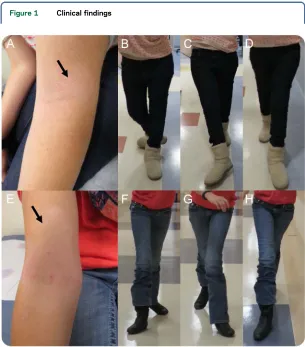 Figure 1Clinical findings