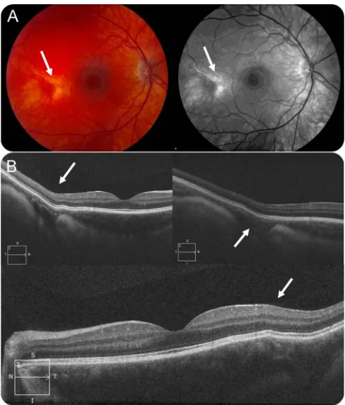 Figure 3Ophthalmologic findings