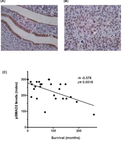 Figure 1. The level of phosphorylated and active SMAD2 (pSMAD2) staining is correlated with poor  patient outcome