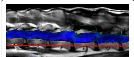 Figure 2 Fiber tracking study of the lumbar spinal cord of adog (no. 13) with the T2w sequence included (lateral view, leftis cranial and right is caudal)