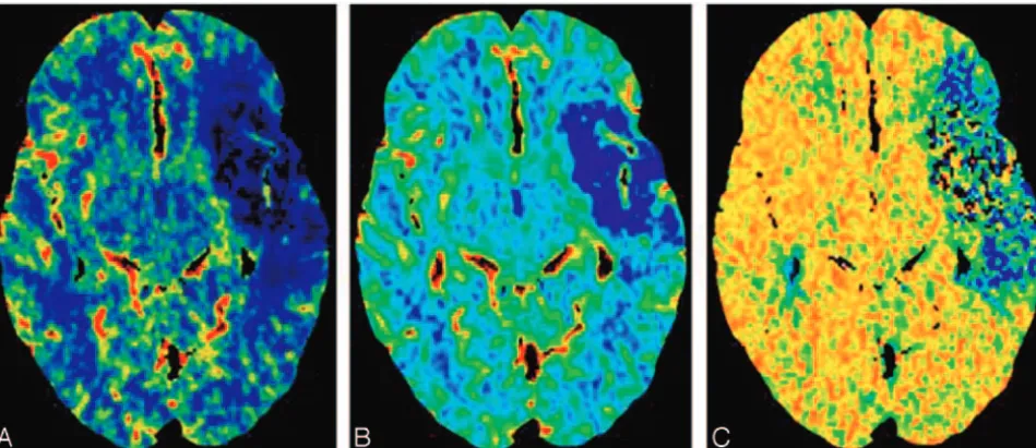 Table 1: Comparison of CTP with MRP imaging