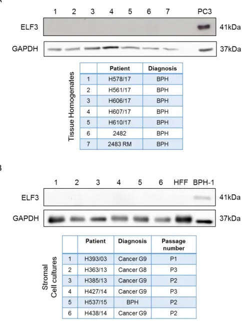Figure 3.4. Protein expression of ELF3 in prostate tissue homogenates and stromal cells
