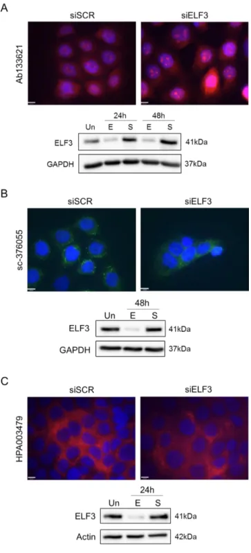 Figure  3.5.  Testing  ELF3  antibodies  for  immunocytochemistry  using  BPH-1  cells  with  ELF3  knockdown