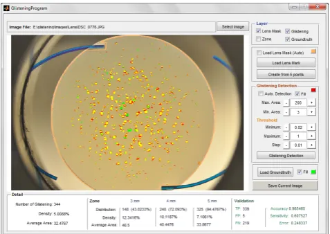 Fig. 10.Screen of program, shows the comparison of detected glisteningsand the ground truth.
