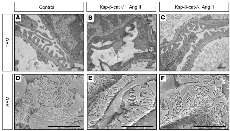 Figure 2. Podocyte foot process integrity is preserved in Ksp-βtreated as in Figure 1
