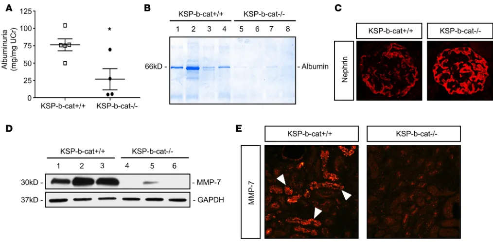 Figure 5. Ksp-βtubules from KSP--cat–/– mice are protected from Adriamycin-induced kidney injury and proteinuria
