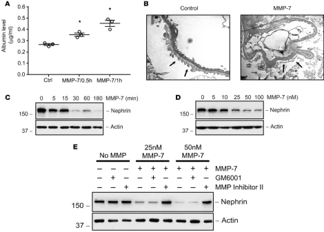 Figure 6. Recombinant MMP-7 decreases nephrin in a time- and dose-dependent manner in ex vivo glomeruli