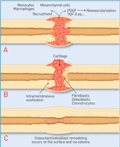 Figure 1: Example of the healing cascade in fracture repair.  