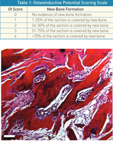 Figure 6: Example of histological section used to grade  osteoinductivity in the athymic mouse Bar = 100 micron.