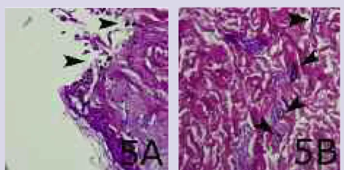 Figure  6A,  B. A)  Wound  treated  with  silver  sulphadiazine (Flamazine)  where  the  keratinocyte  layer  shows  a  slight discoloration,  but  no  particles