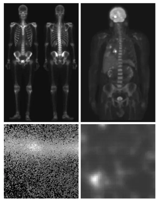 FIGURE 1.6 Examples of gamma-ray imaging. (a) Bone scan. (b) PET image. (c) Cygnus Loop