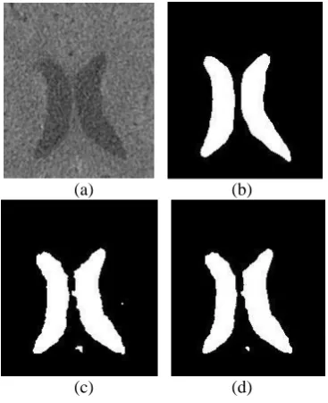 Fig.6 shows the characteristic of bow-tie operator 