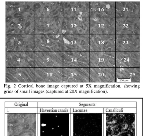 Fig. 1. Bone sample preparation and imaging  a) the section cut showing the polar coordinate system and the position where the slice was cut, b) the slice after pathological processing, c) the image captured at 5x magnification, d) one of the images captures at 20x magnification  
