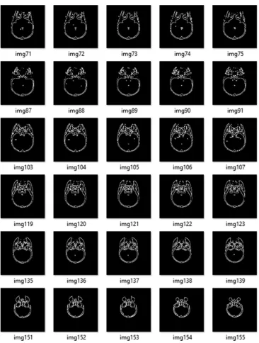 Fig. 6. Part of the segmented two-dimensional slices (edge-based segmentation)