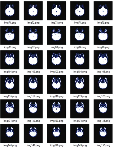 Fig. 7. Part of the obtained two-dimensional slices (region-based segmentation)
