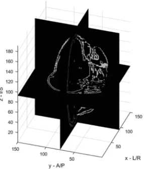 Fig. 8. The segmented three-dimensional image
