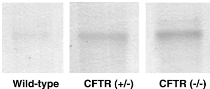 Figure 2Western Blot of Ileal Brush Border Proteins from Wild-Type, Heterozygous and Cystic Fibrosis Mice