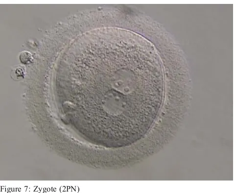 Figure 8: Embryo Grade 1