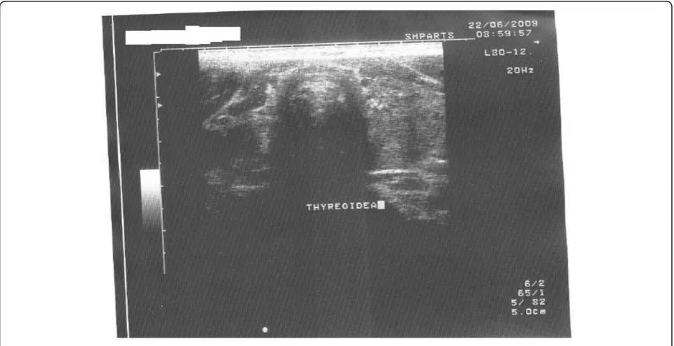 Figure 1 Neck ultrasound.