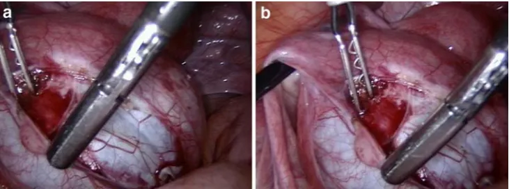 Fig. 1 a The picture shows the