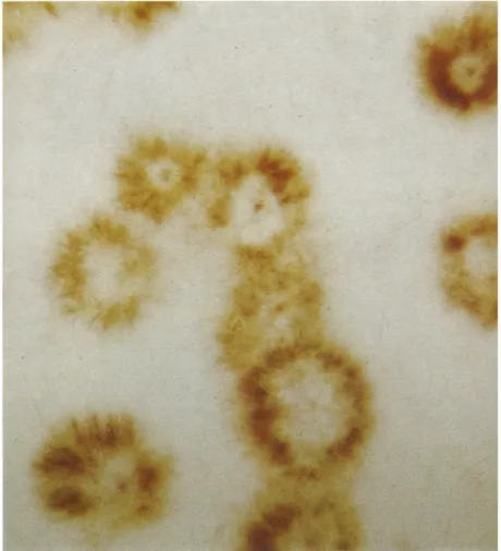 Fig. 2: Culture from Figure 1 treated with Berbelin blue-I solution. (Scale 2.1:1) 