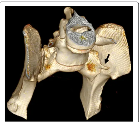 Table 2 Abnormal computed tomography findings ofsacrum and their correlation with radiographs in nineGerman shepherd dogs