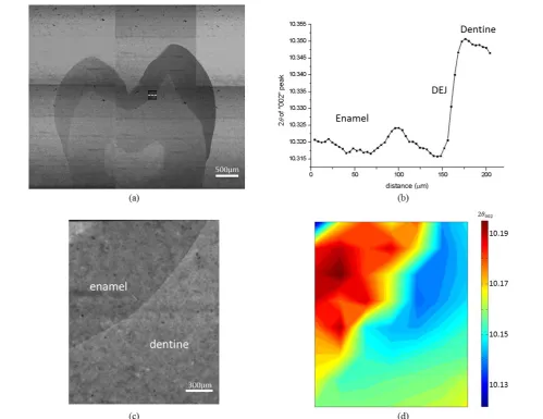 Fig. 2 Micro-beam X-ray diffraction mapping of dental slice; (a) radiographic image of dental slice; (b) high resolution line scan across the DEJ; the transition feature of the DEJ is clearly shown; (c) radiographic image of the region of interest (ROI); d) phase mapping of dentine and enamel by interpreting (002) peak   